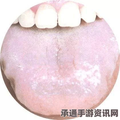 日本研发首个人工舌头，为失去舌头的人带来发声的希望（图）