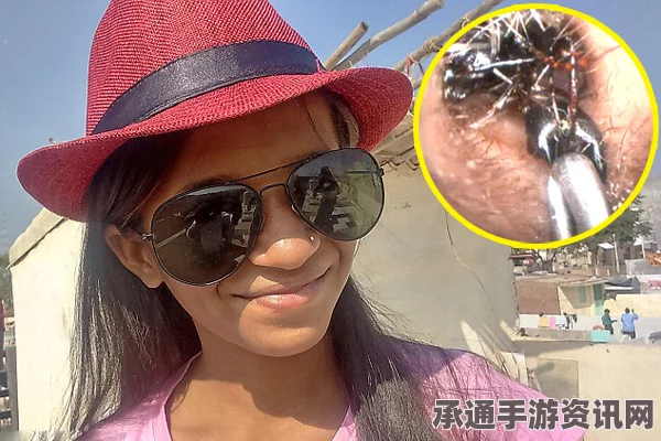 印度少女耳朵惊现蚁穴，奇特现象揭秘与应对技巧探讨
