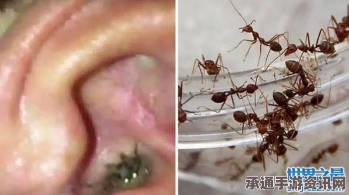 印度少女耳朵惊现蚁穴，奇特现象背后的应对技巧与方法