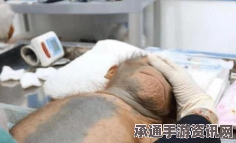 猴子换头手术新进展与缝合照片曝光，英媒宣布将探索人头移植术的突破与挑战