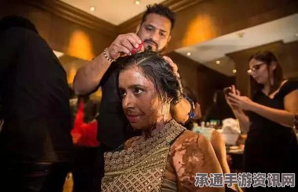 印度女子逆境重生，悔婚后遭泼酸毁容，凭借自强自信成为服装模特之路
