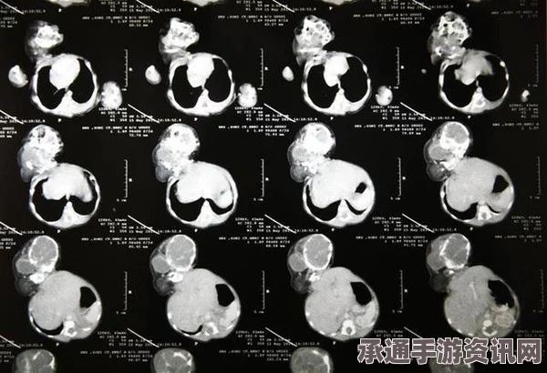 印度双头宝宝的诞生与夭折，医学奇迹的挑战与反思