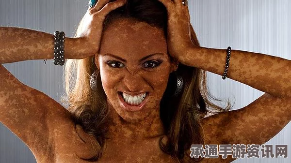 女子患罕见皮肤病昼夜颠倒生活，应对与挑战