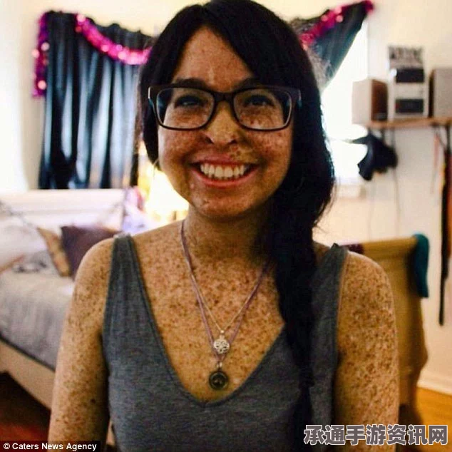 女子患罕见皮肤病昼夜颠倒生活，应对与挑战
