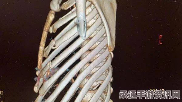 俄男子奇迹生还，从5层楼坠落仅断一根肋骨，探讨生存技巧方法