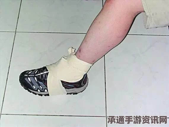 七日杀扭伤腿疾病应急处理指南，实用技巧与方法