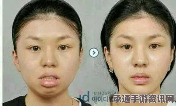 韩国三姐妹整容狂热，一年内超百次重塑美丽，连吃饭钱都舍得投入
