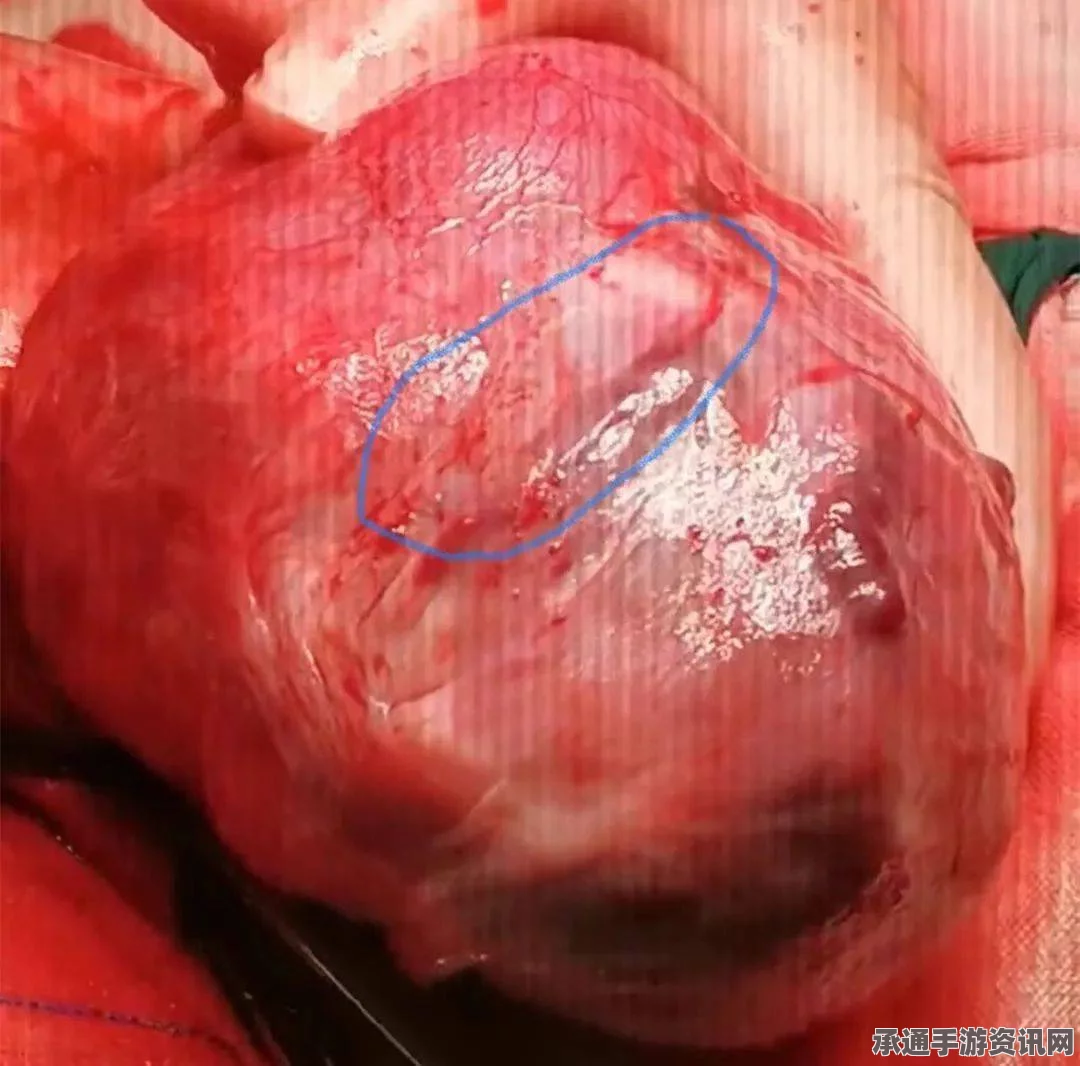 泰一母象产后子宫溃烂，世界首例输血手术成功拯救濒危生命