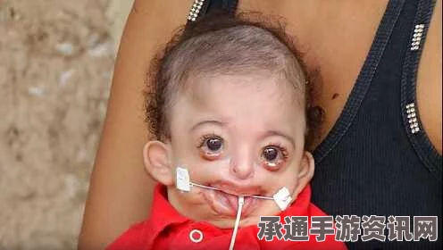 埃及婴儿一只眼畸形，放射物影响的可能性及应对技巧方法