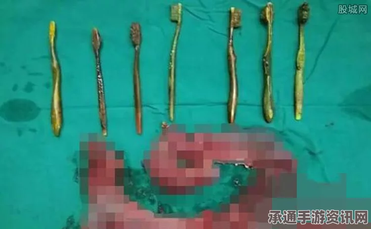 女子误用工业发泡剂当摩丝，头顶菜花状异物就医—事件背后的应对技巧与注意事项